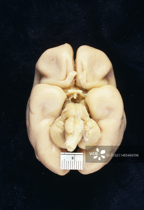 胎儿大脑图片素材