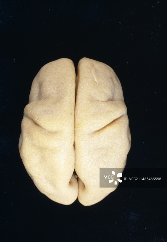 胎儿大脑图片素材