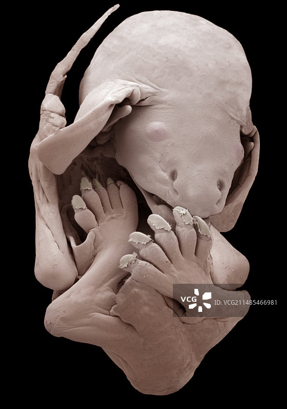 棕色长耳蝙蝠胎儿，扫描电镜图片素材