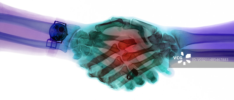 握手，X光图片素材