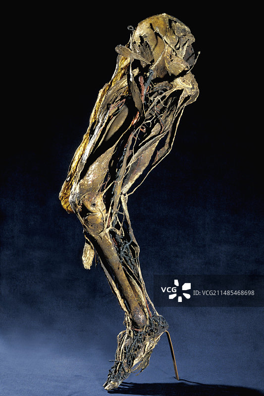 人体腿部解剖结构，弗拉戈纳尔博物馆图片素材