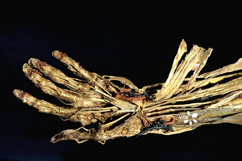 人体手部解剖结构，弗拉戈纳尔博物馆图片素材