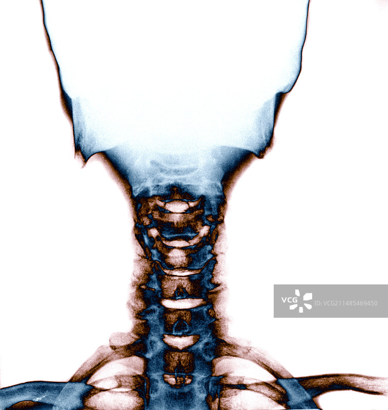 颈部和头骨X光片图片素材