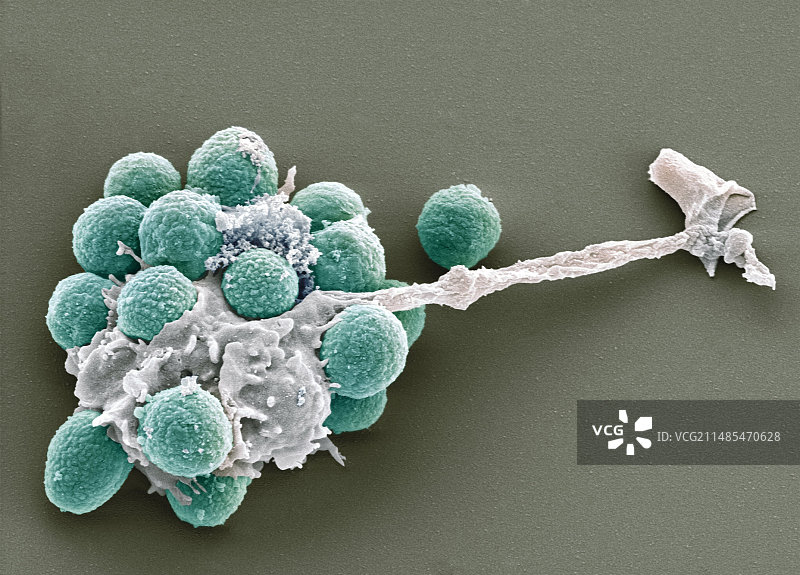 真菌孢子的吞噬作用，扫描电镜图片素材