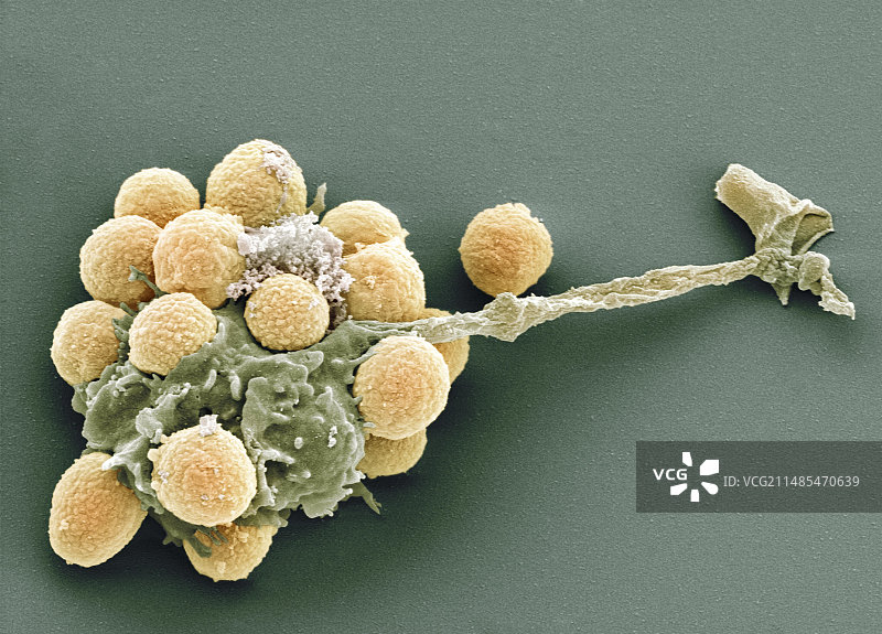 真菌孢子的吞噬作用，扫描电镜图片素材