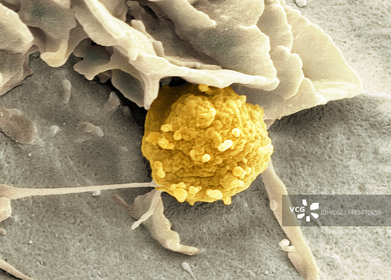 真菌孢子的吞噬作用，扫描电子显微镜图片素材