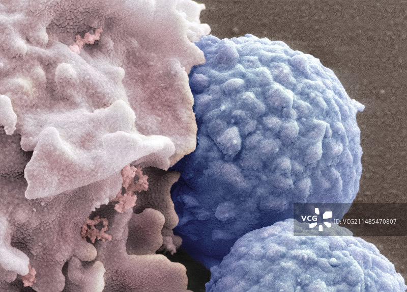 真菌孢子的吞噬作用，扫描电镜图片素材