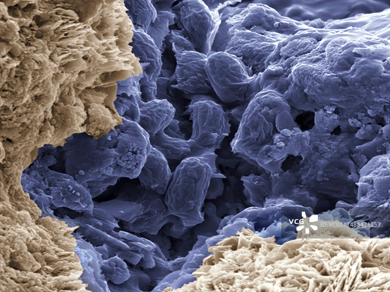 蜡样芽孢杆菌扫描电镜图图片素材