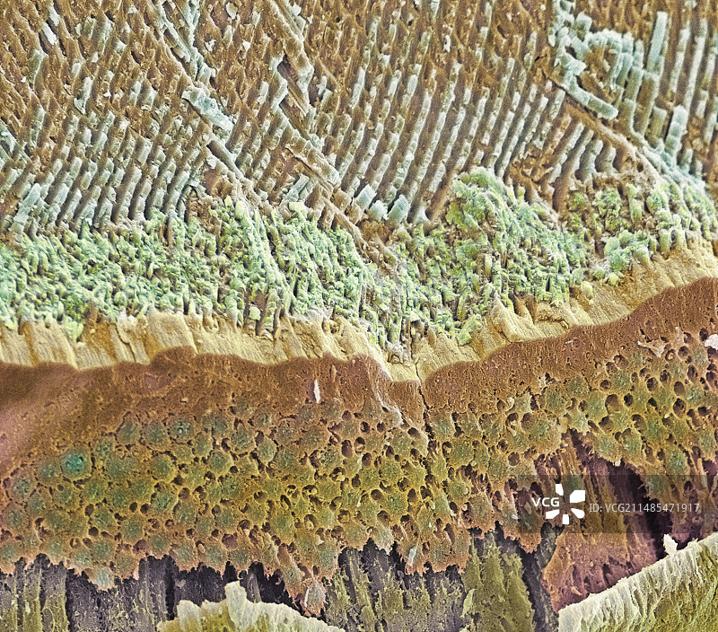 牙釉质形成扫描电镜图图片素材