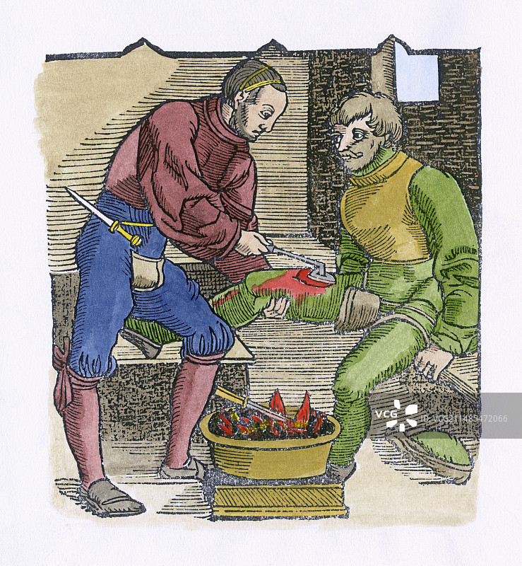 16世纪的伤口烧灼术图片素材