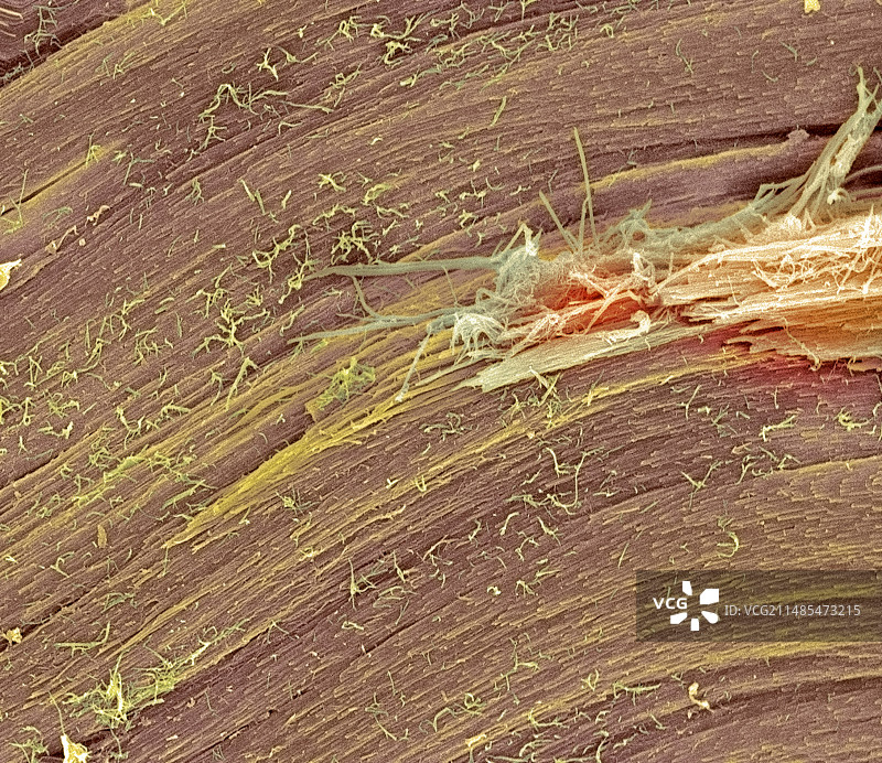 肌腱纤维，扫描电镜图片素材