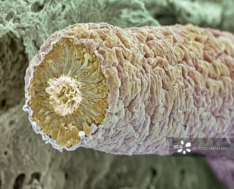 精子产生部位，扫描电子显微镜图片素材