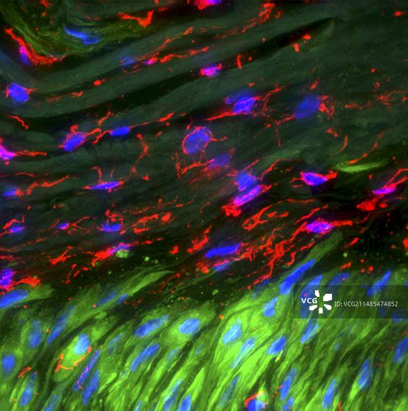 动脉组织层图片素材