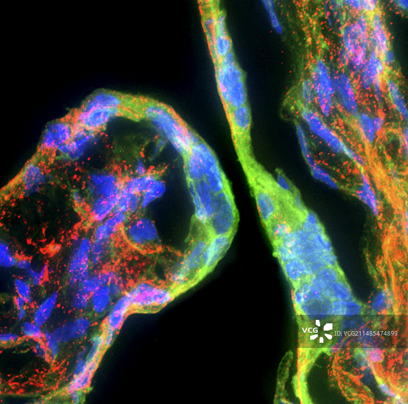 胎盘的形成图片素材