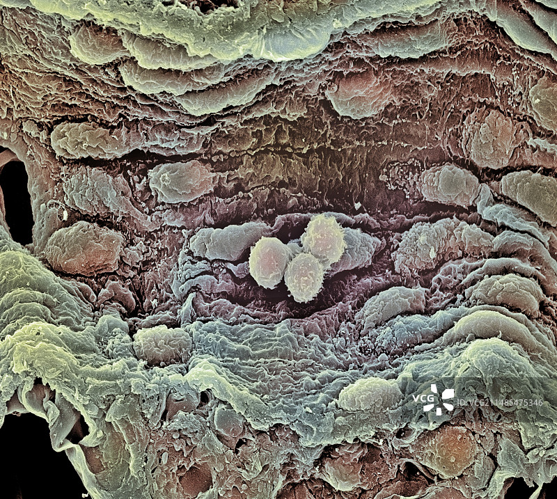 血管扫描电镜图图片素材