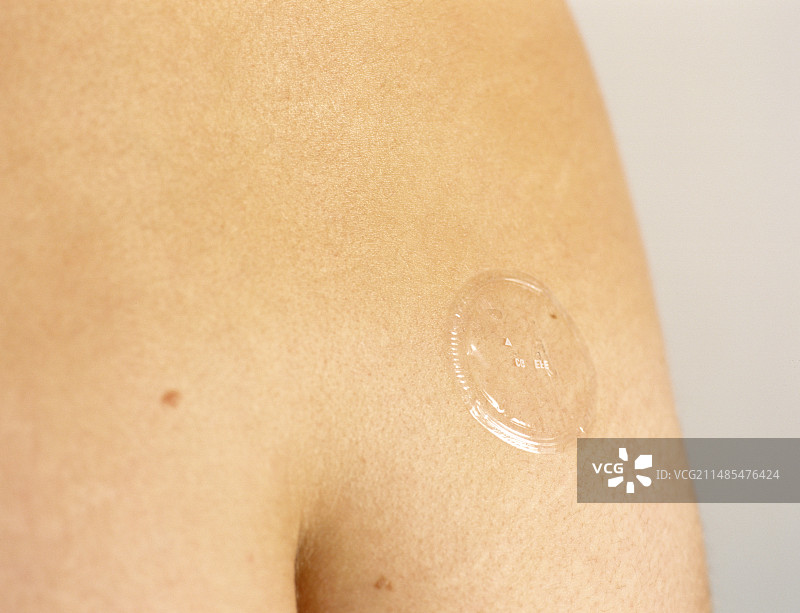 激素替代疗法皮肤贴片图片素材