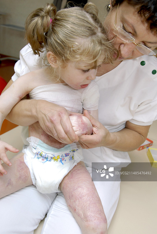 烧伤康复图片素材