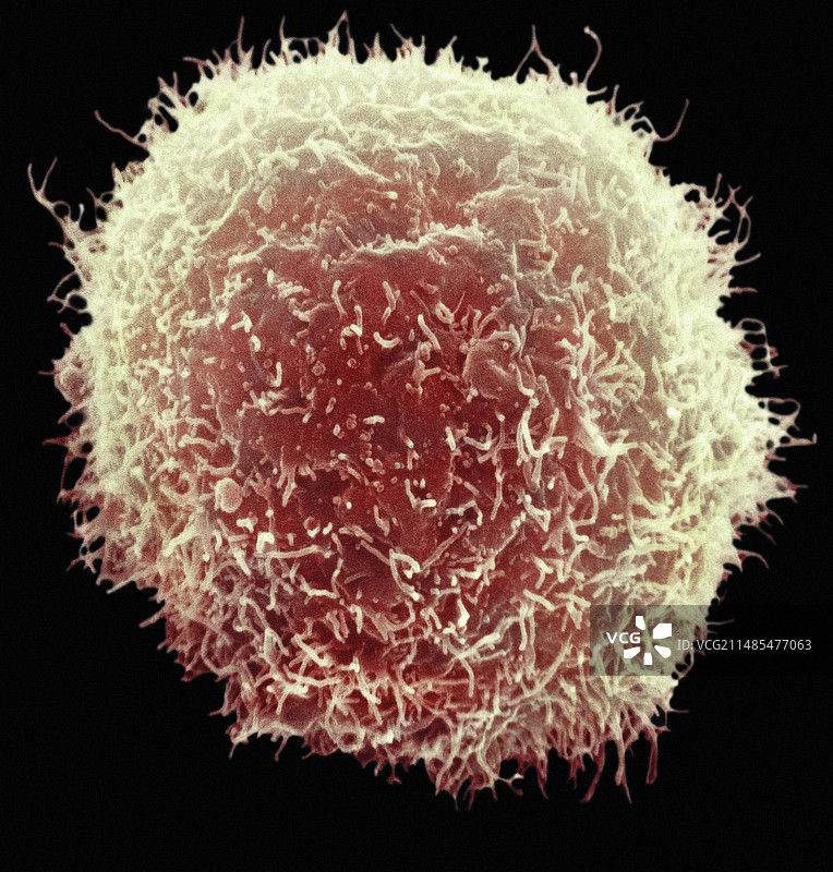 巨噬细胞扫描电镜图图片素材