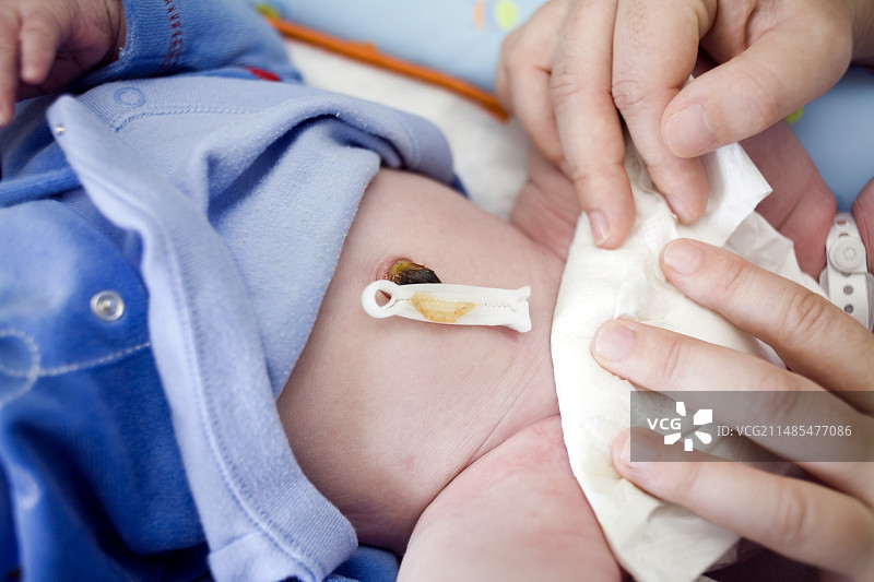 脐带夹图片素材