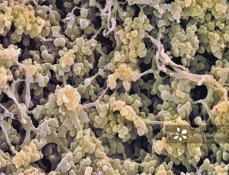 白细胞扫描电镜图图片素材