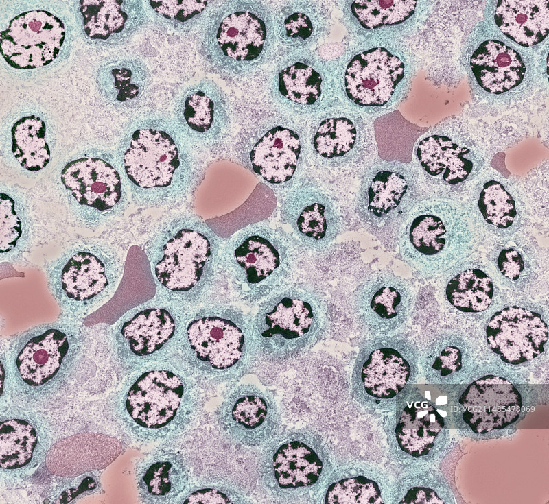 白血病细胞，TEM图片素材