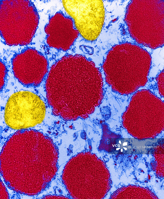 肥大细胞颗粒图片素材