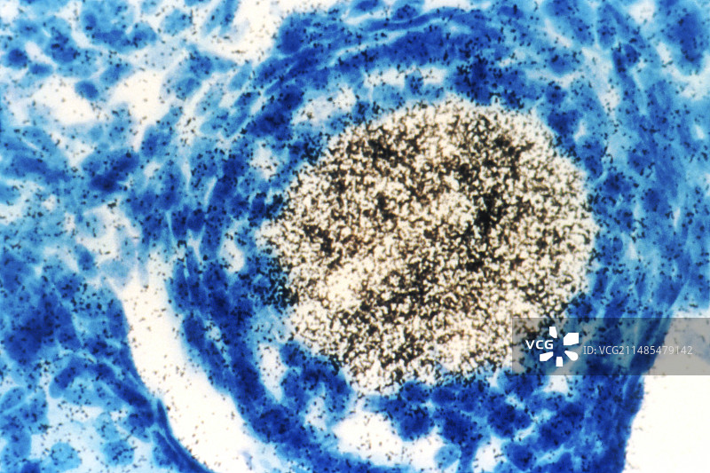 基因表达研究图片素材