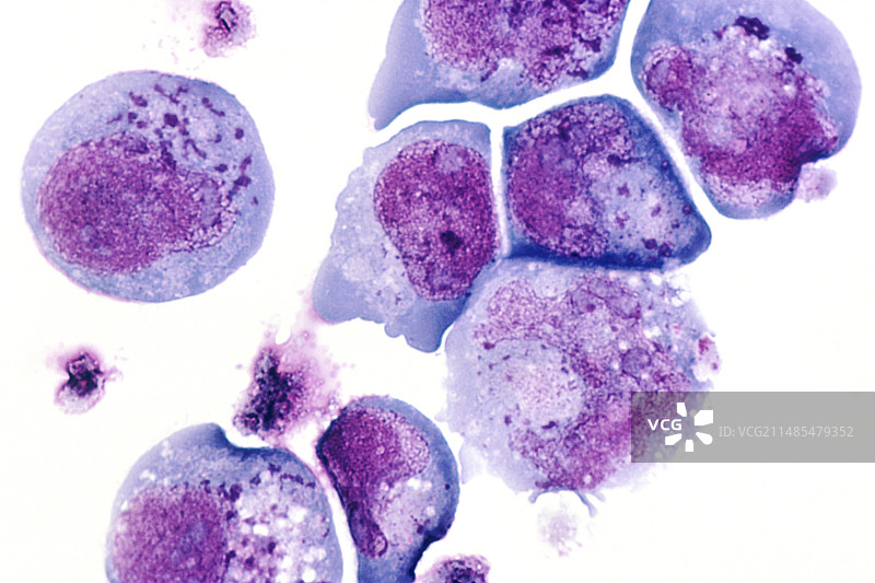 感染疱疹病毒的白细胞，LM图片素材