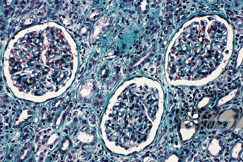 肾小球图片素材