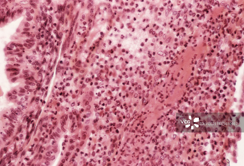 子宫内膜图片素材