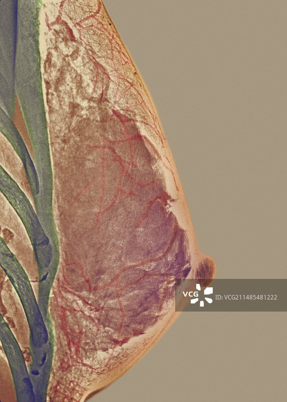 乳房X光片图片素材