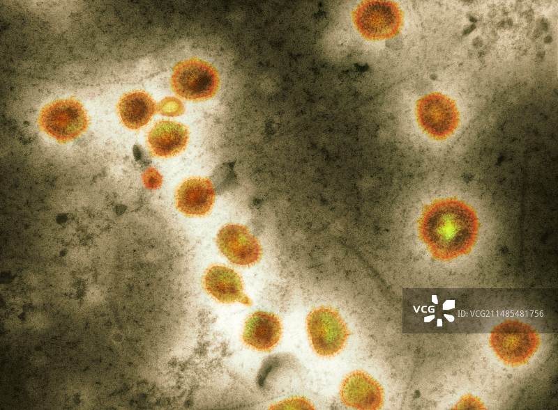 禽流感病毒颗粒（透射电镜）图片素材