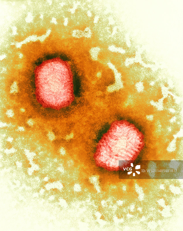传染性软疣病毒TEM图片素材