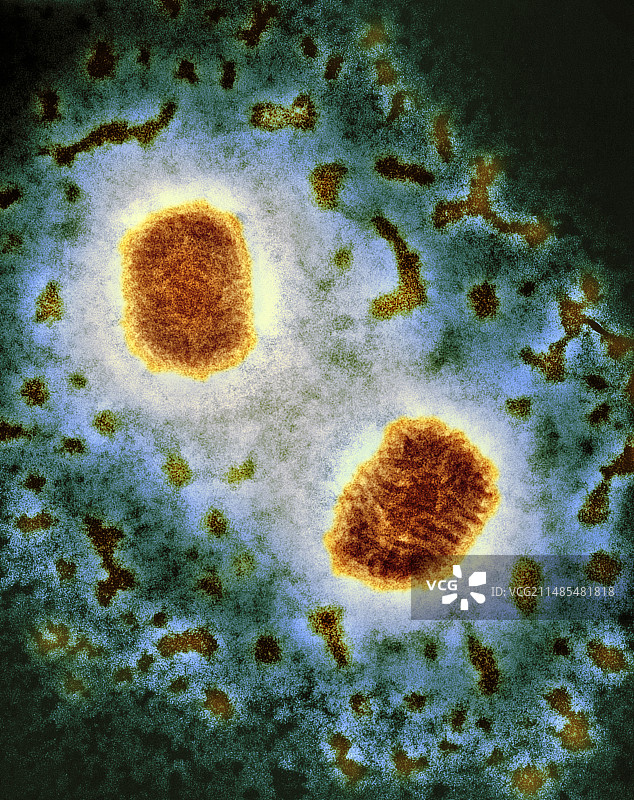 传染性软疣病毒TEM图片素材