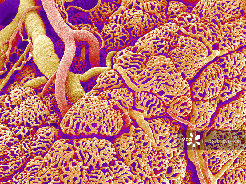 甲状腺血管扫描电镜图图片素材