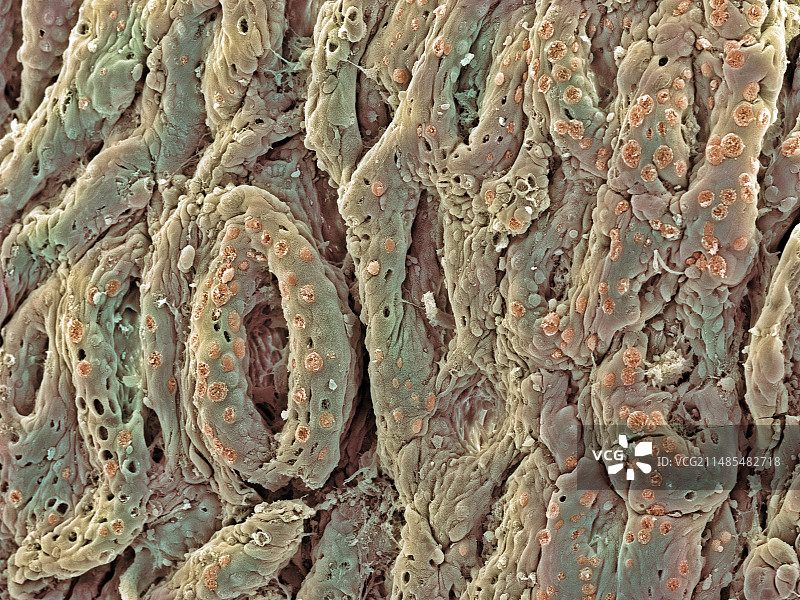 溃疡性结肠炎扫描电镜图图片素材