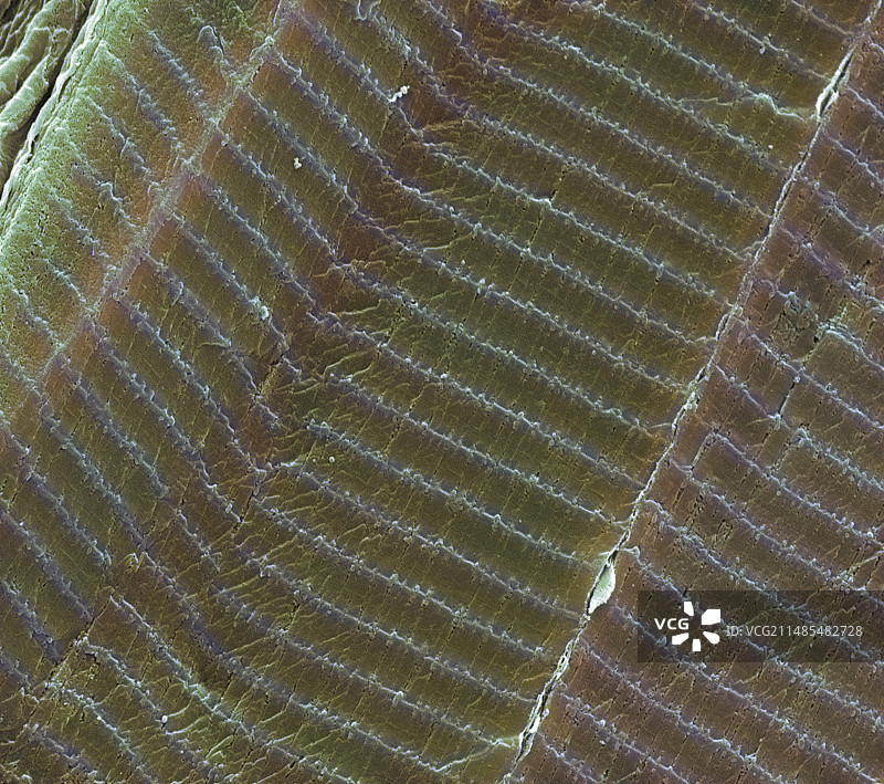 骨骼肌，扫描电镜图图片素材