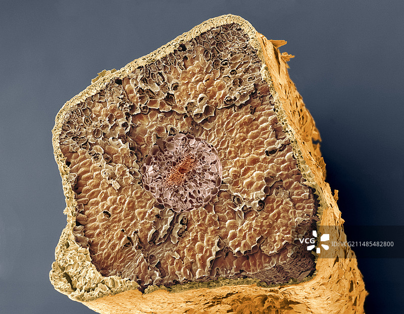 针叶树针，扫描电子显微镜图片素材