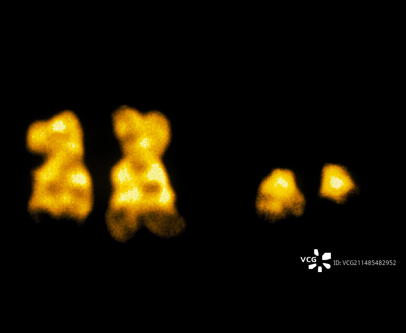 费城染色体图片素材