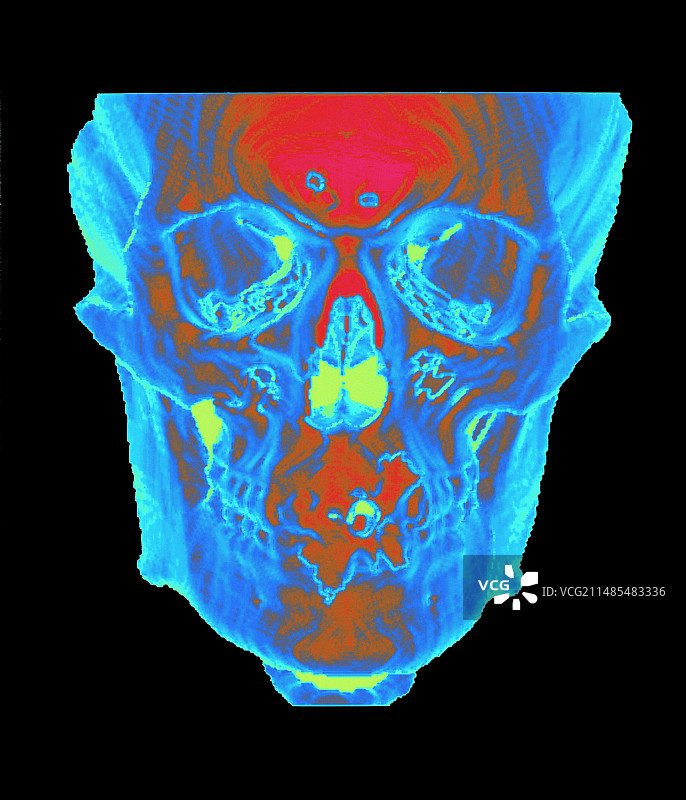 骷髅CT扫描图片素材