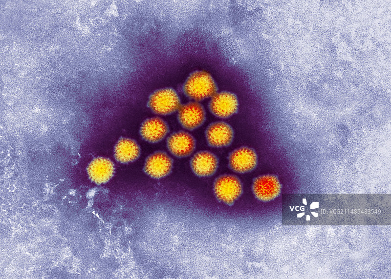 轮状病毒颗粒（透射电子显微镜）图片素材