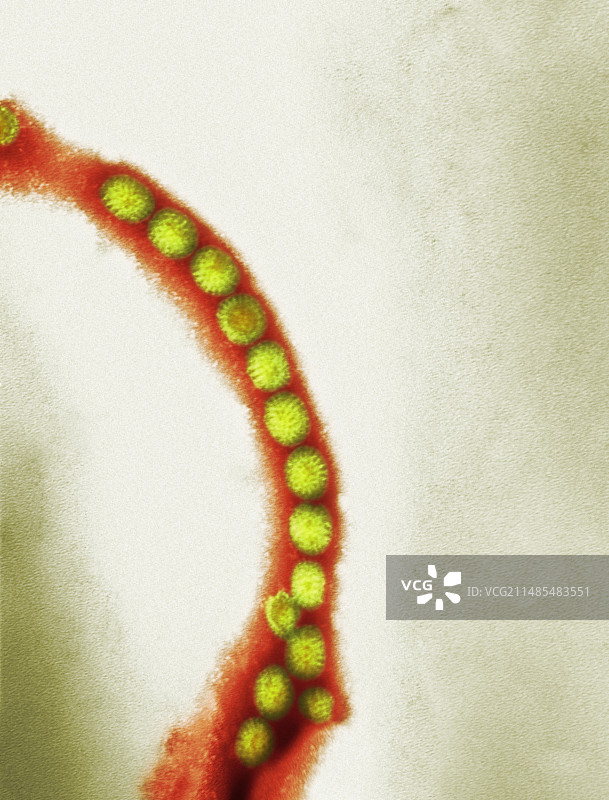 轮状病毒颗粒（透射电子显微镜）图片素材