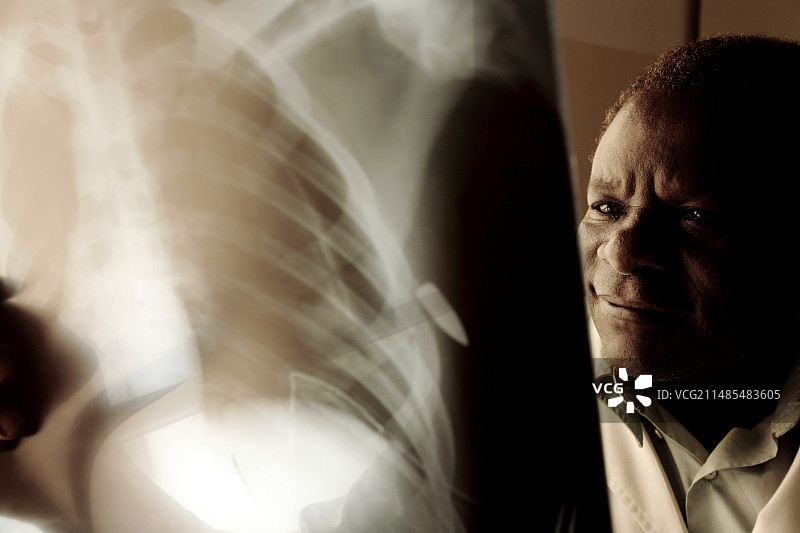 医生查看X光片图片素材