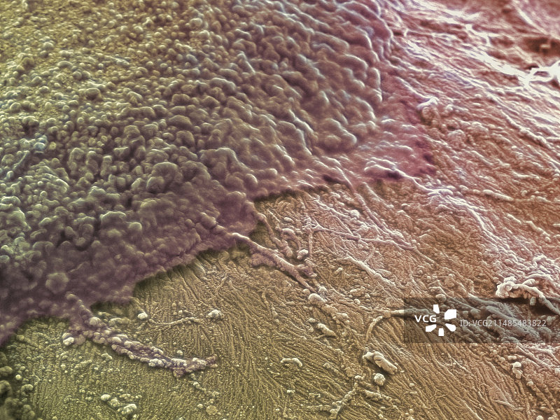 骨吸收扫描电镜图片素材