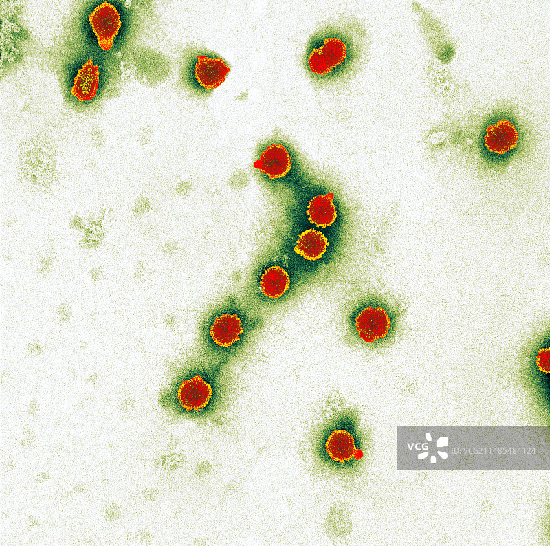 禽流感病毒颗粒（透射电镜）图片素材