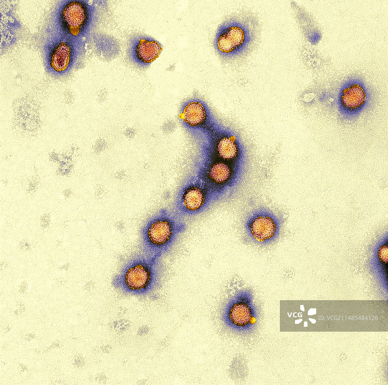 禽流感病毒颗粒（透射电镜）图片素材