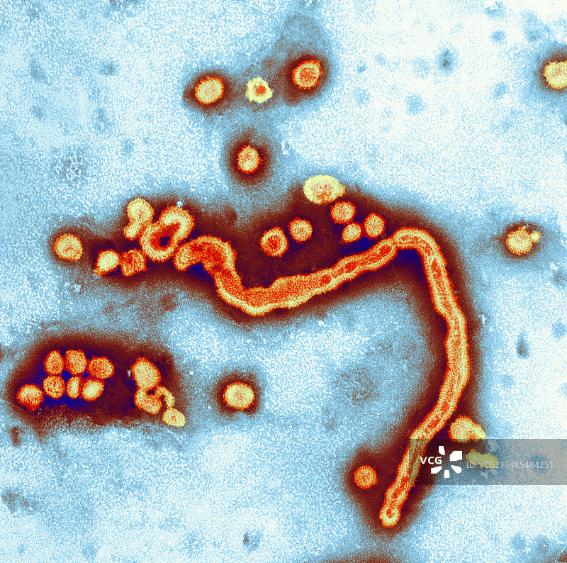 甲型流感病毒，透射电镜图片素材