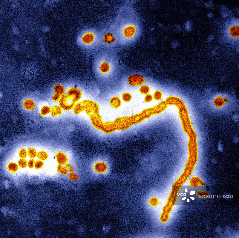 甲型流感病毒，透射电镜图片素材