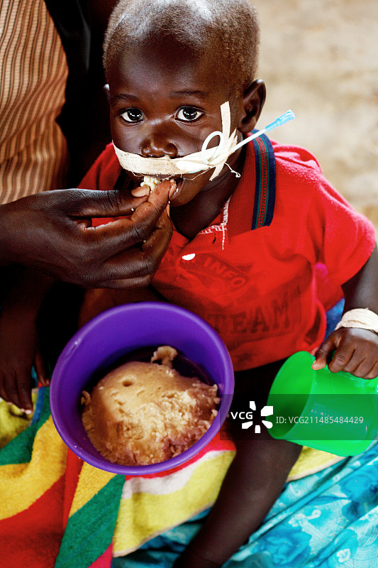正在被喂养的营养不良儿童图片素材