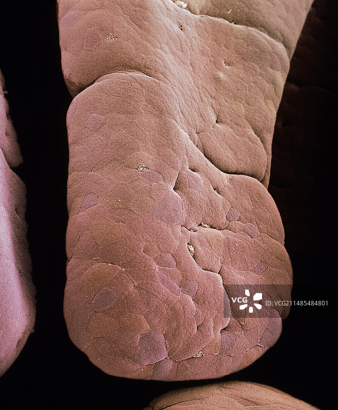 小肠绒毛扫描电镜图图片素材